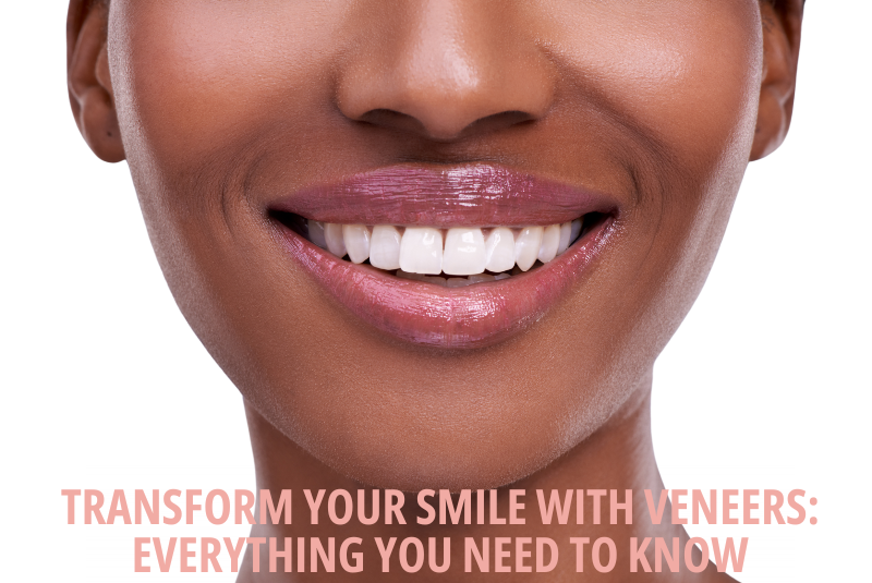 Transform Your Smile with Veneers Everything You Need to Know